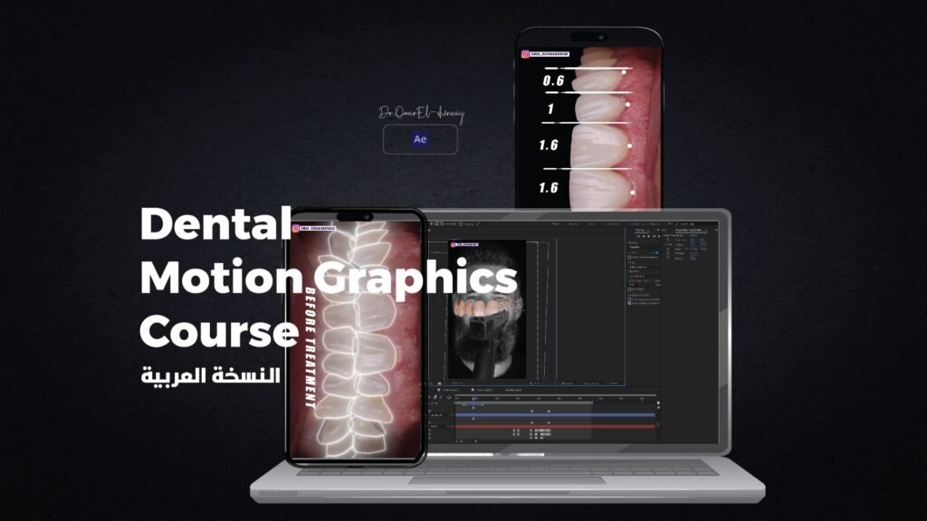 دنتال موشن 2
