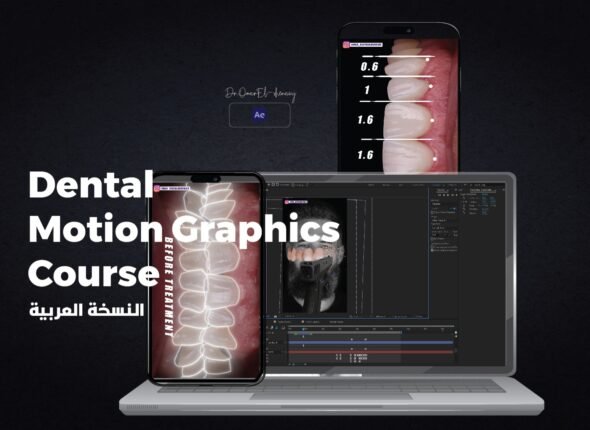دنتال موشن 2